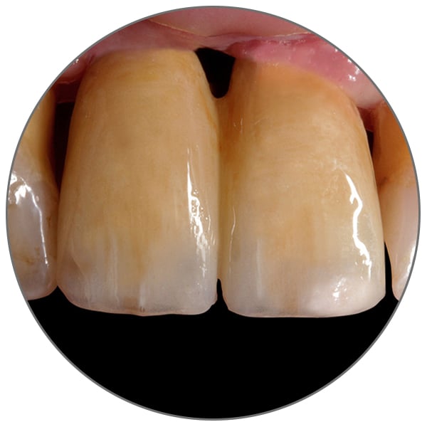 rundes-Vorschaubild_Jürgen-Freitag_2_600x600