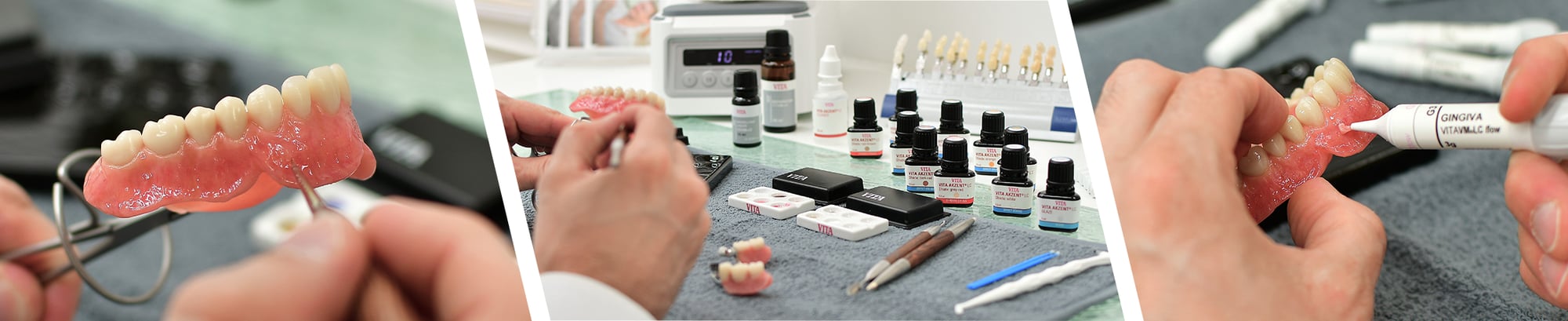 Echte Zahnunikate durch die Charakterisierung mit VITA AKZENT LC