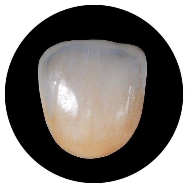 Translucidez incisal