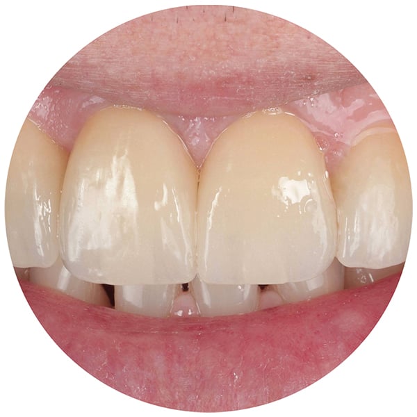 Losas_Fallbild_600x600