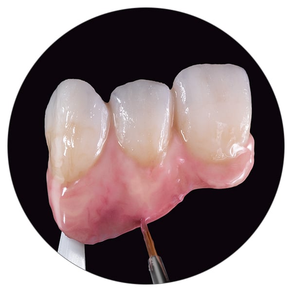 Pink Ästhetik - Naturgetreue Reproduktion der Gingiva.