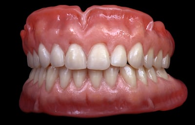 3. The highly-esthetic, full denture work simulates the anatomy perfectly. 