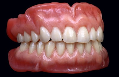 4. The three-dimensionally layered VITA MFT appears absolutely natural in combination with the denture bases.