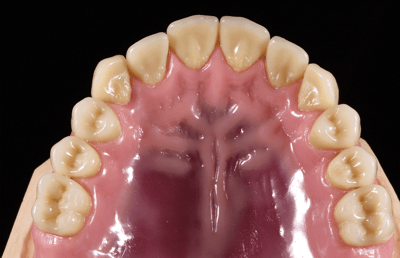  The palatal anatomy was also reproduced meticulously.