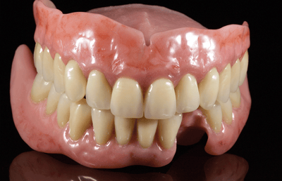 les restaurations maxillaire et madibulaire après leur réalisation en polymère.