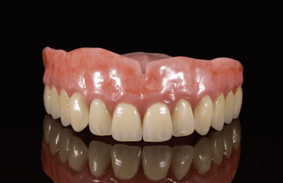 Gingival anatomy was simulated with internal colors.
