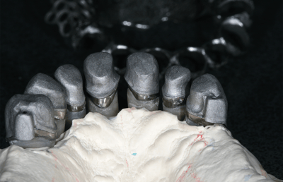 9. The secondary on the primary crowns. 