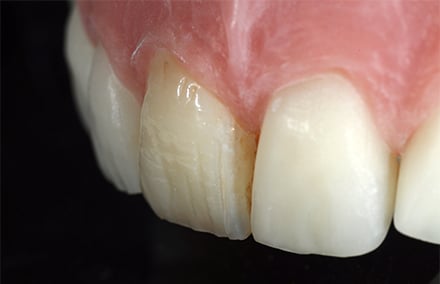 13. Die laterale Perspektive zeigt die Harmonie zwischen Morphologie und Charakterisierung.