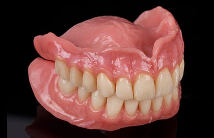 21. Der Blick von lateral zeigt die dreidimensionale Tiefenwirkung der mukogingivalen Anatomie.