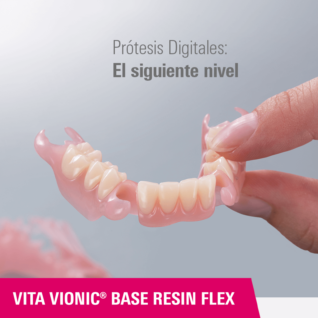 Material de impresión 3D para la confección de bases de prótesis flexibles: VITA VIONIC BASE RESIN FLEX