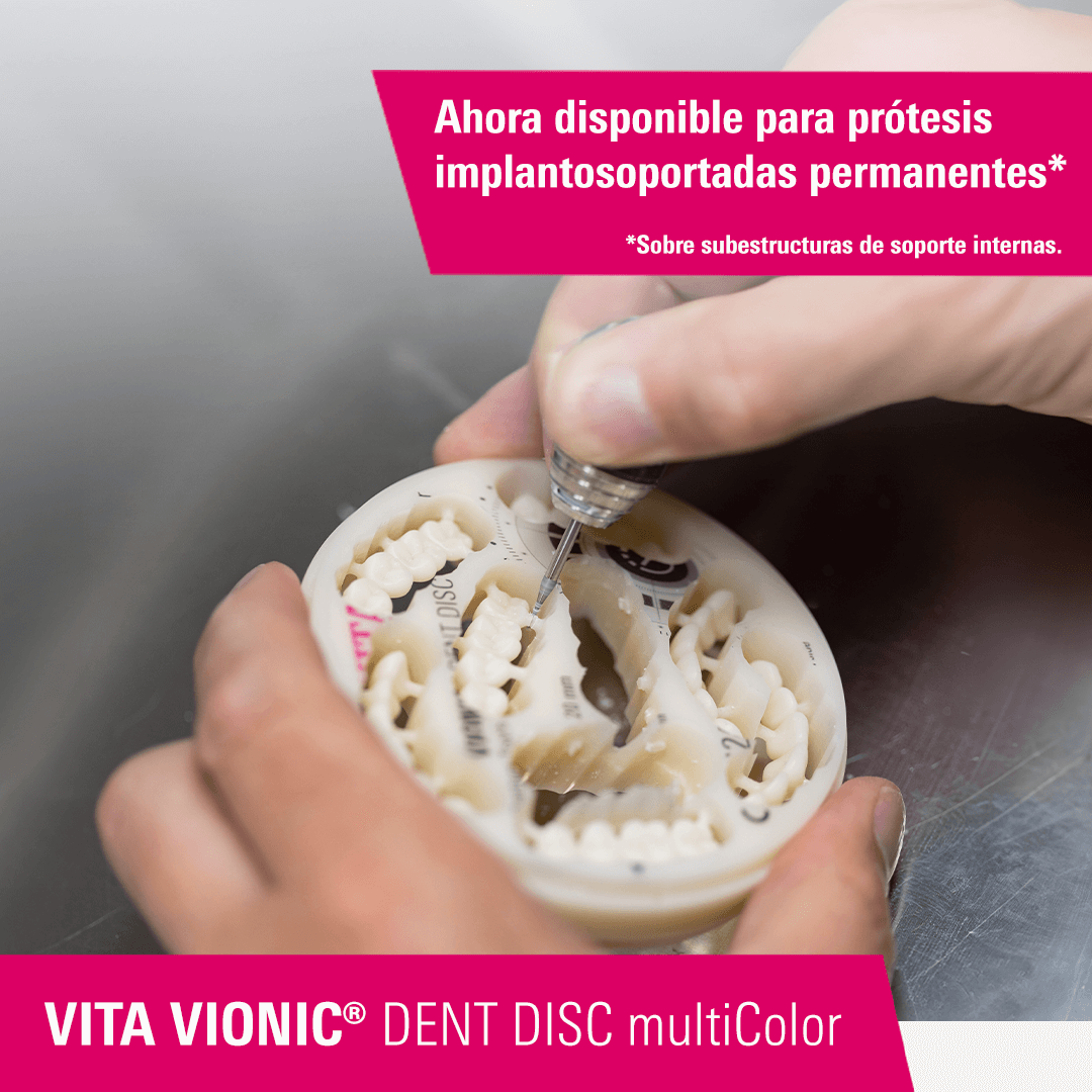 VITA VIONIC DENT DISC multiColor - Ahora disponible para prótesis implantosoportadas permanentes.