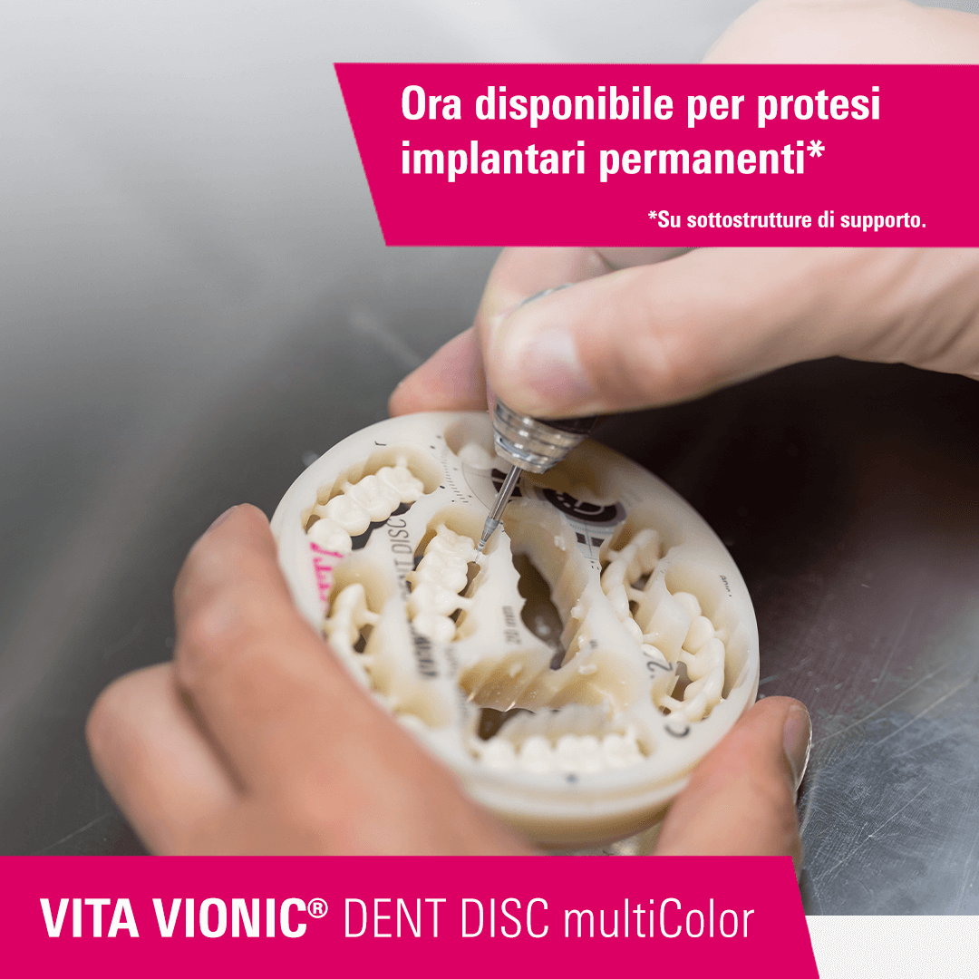 VITA VIONIC DENT DISC multiColor - Ora disponibile per protesi implantari permanenti.