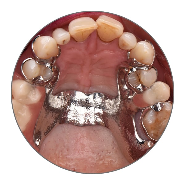 VITA VIONIC SOLUTIONS