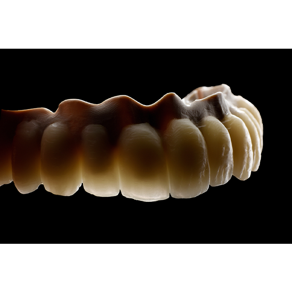 5. The dental arch attached to the secondary framework showed vivid translucency.