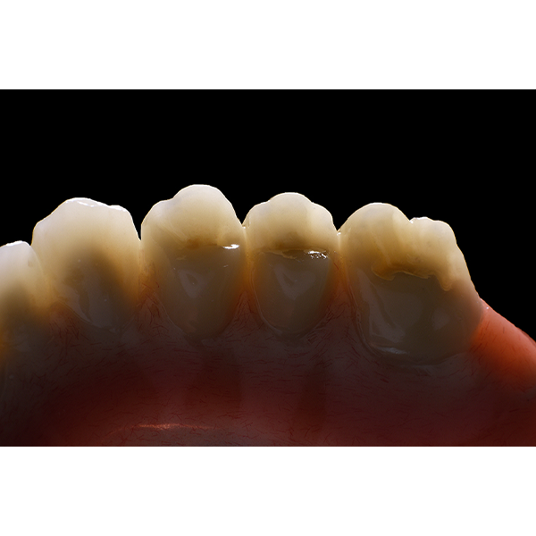 8. Macroscopic view of the posterior teeth with natural translucency and shade gradient.