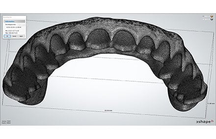 5. The STL file of the dental arch for the denture.