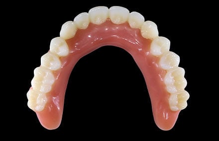 7. The completed digital denture.