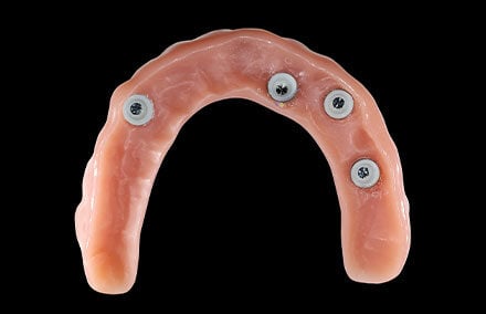 8. Basal view of the denture with the integrated matrices.