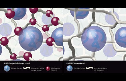 10. Résine composite VITA MRP hautement réticulée,  comparaison schématique avec du PMMA non chargé.