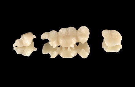 13. El material dental para la prótesis esquelética tras la separación de los conectores.