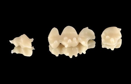 14. The retention pins for the dental material can be seen in the basal view.