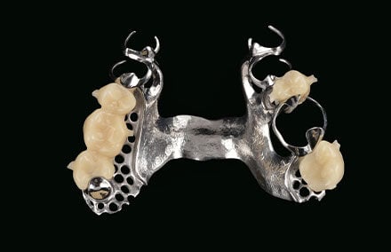 15. The denture components fit together perfectly like a plug-in system.