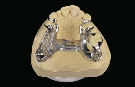 3. La struttura scheletrata è stata realizzata da un laboratorio esterno.