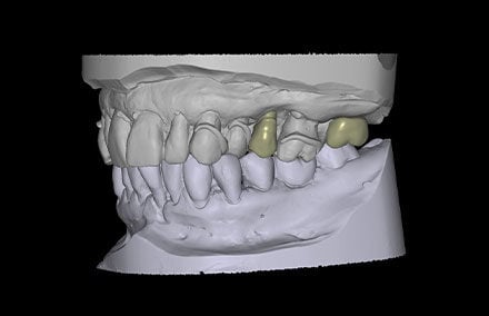 8. Specialmente in presenza di spazi ridotti, può essere realizzato un adattamento preciso.