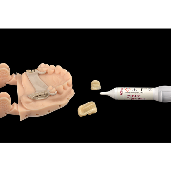 11. The cold-curing polymer resion VITA VM CC was used for cementation.