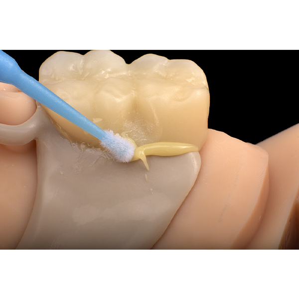 13. Removal of excess using the microbrush.