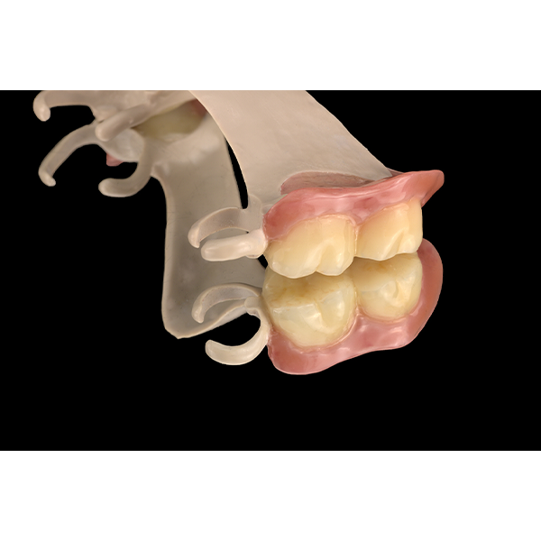 16. L'andamento cromatico degli elementi dentali sui denti 26 e 27 aveva un aspetto assolutamente naturale.