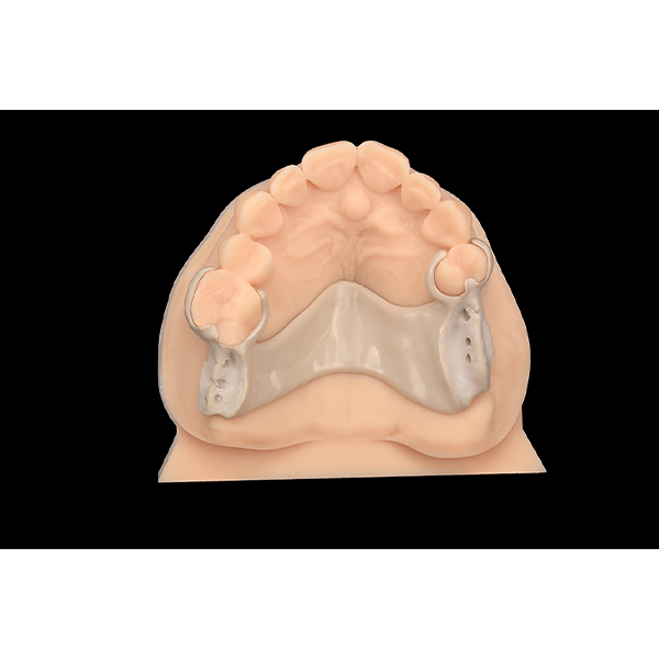 5. The framework of the partial denture was fabricated from PEEK, supported by CAD/CAM.