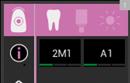 El color dental se determinó con precisión mediante el espectrofotómetro VITA Easyshade V. 