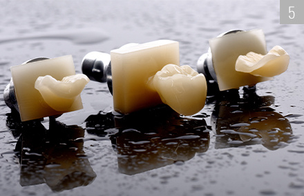 In a very short time with the validated grinding strategy absolutely precise and lifelike restorations were created.