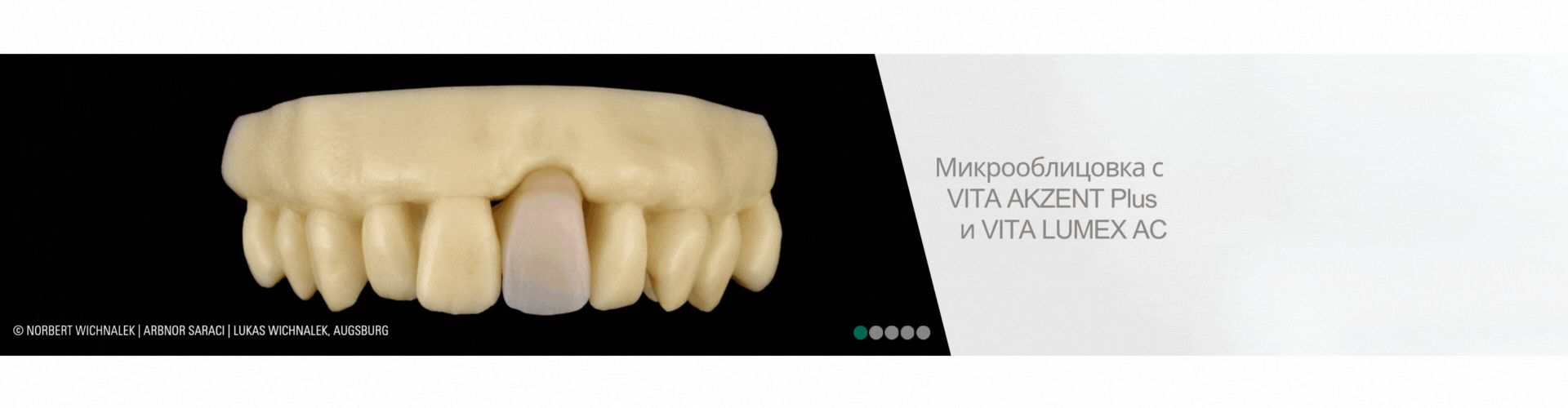 Micro-Veneering_RU_VITA LUMEX AC_Next Generation of Veneering_1920x500 (1)