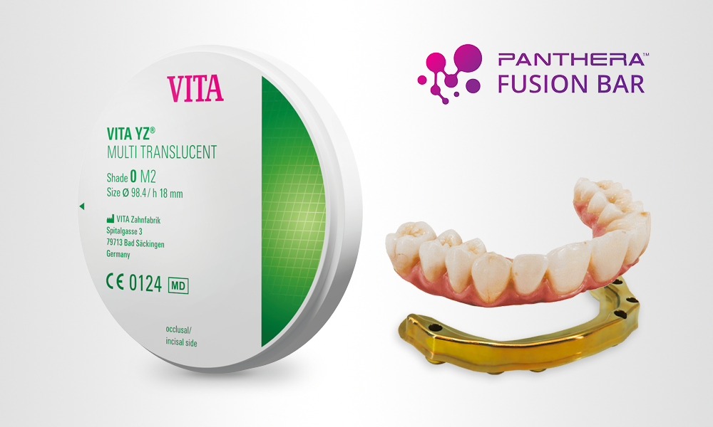 Panthera Fusion Bar™ trifft auf VITA YZ® MULTI TRANSLUCENT Panthera Fusion Bar™ trifft auf VITA YZ® MULTI TRANSLUCENT
