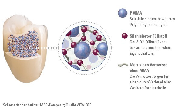 VITA Prothesenzähne bestehen aus hochwertigem MRP-Komposit, Füllstoffe sorgen für hohe Abrasionsstabilität.