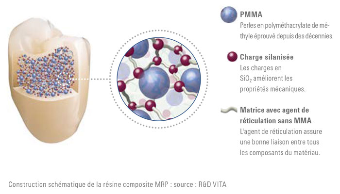 Les dents prothétiques VITA sont composées d'un composite MRP de haute qualité, des charges garantissent une grande résistance à l'abrasion.